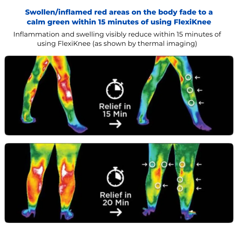 FlexiKnee - Portable Knee Pain Massager