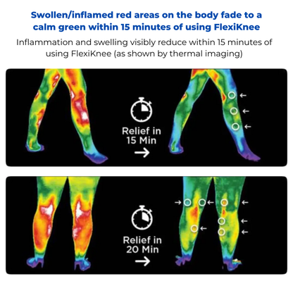 FlexiKnee - Portable Knee Pain Massager